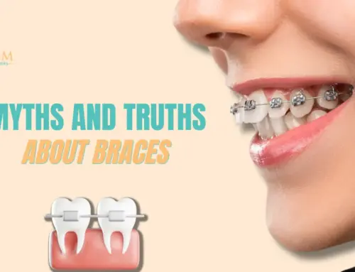Myths and Truths about Braces – North Miami FL