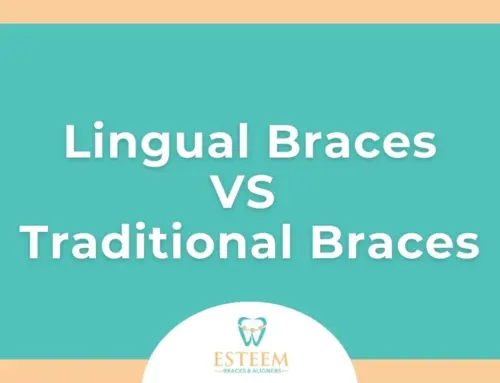 Lingual Braces vs Traditional Braces in North Miami Beach and Kendall, FL