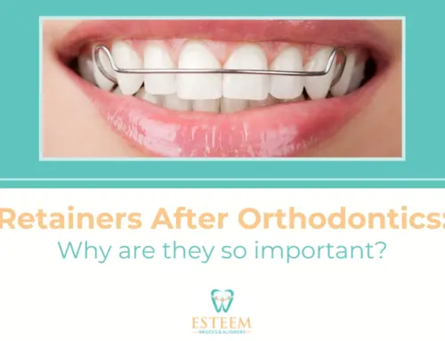 Retainers After Orthodontics: Why are they so important?