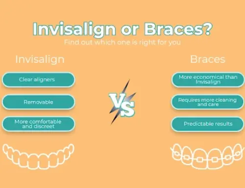 Invisalign or Braces in North Miami Beach